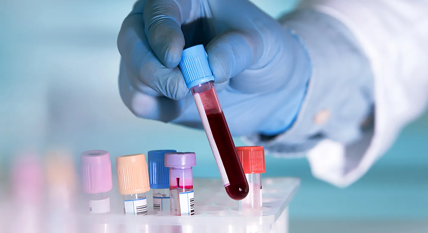 Relación entre el síndrome cardiovascular-reno-metabólico y el cáncer
